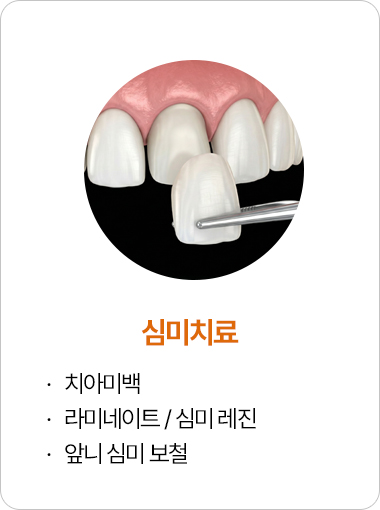 심미치료