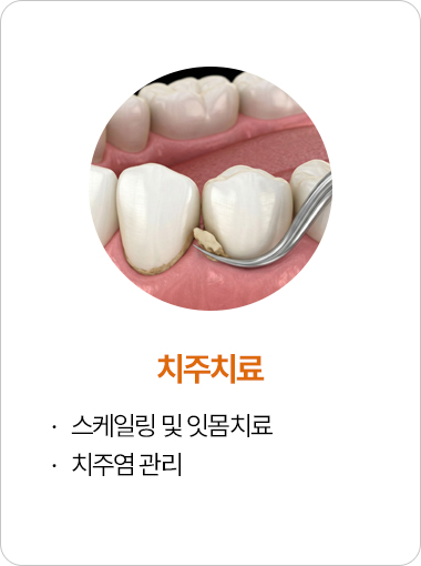 치주치료